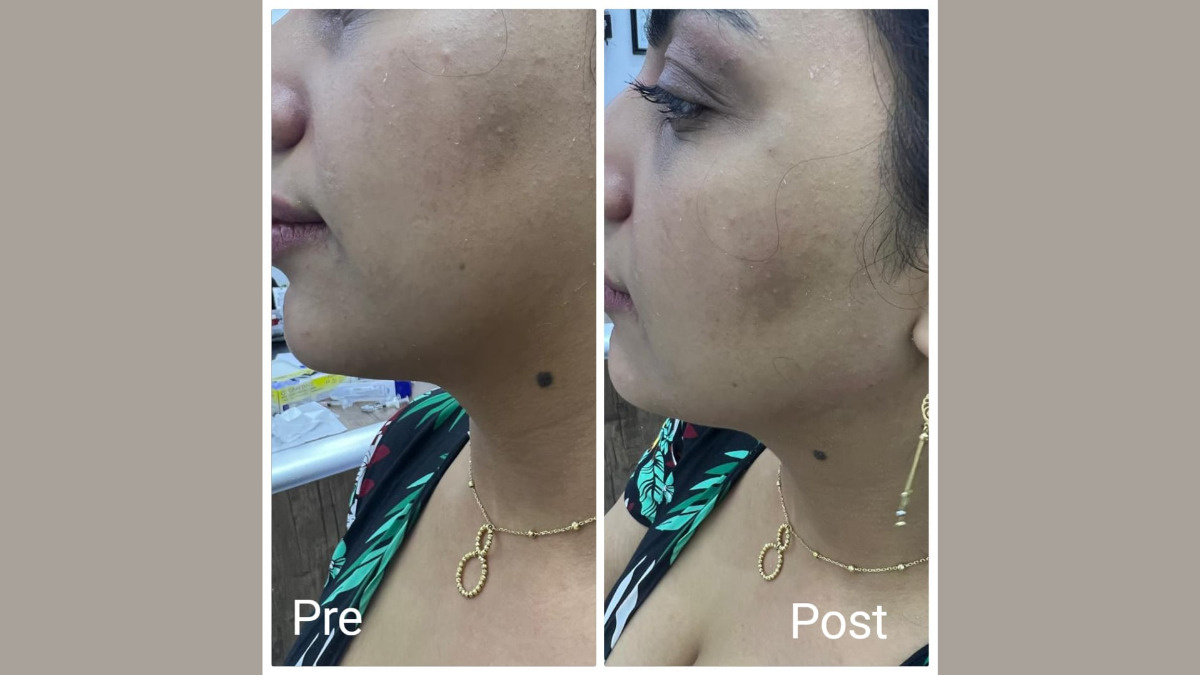 تحديد الفك في الغردقة